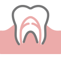 歯が痛む・しみる一般歯科・根管治