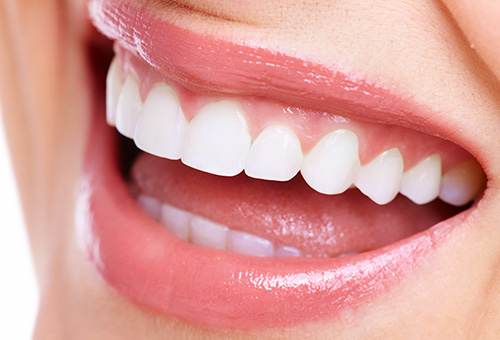 銀歯が気になる、天然の歯を白くしたい方の審美治療